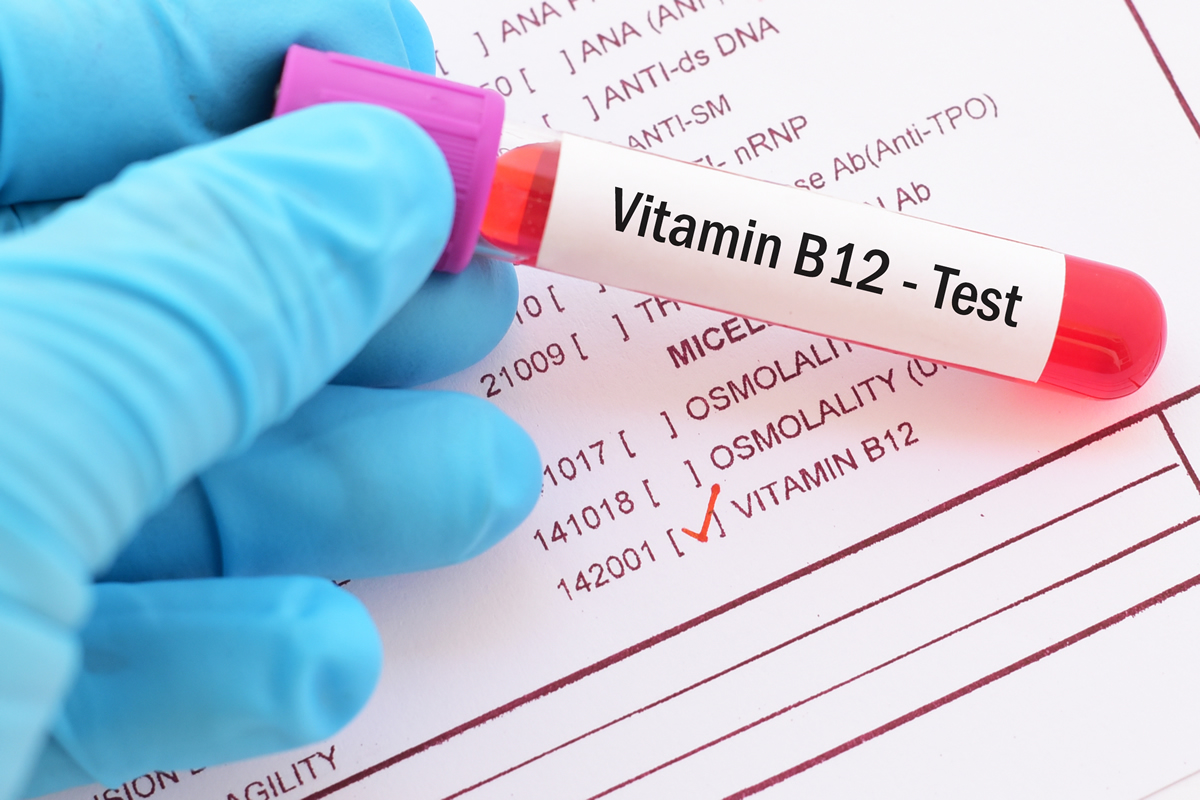 Carenza vitamina B12